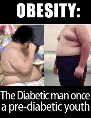 obesity-diabetes