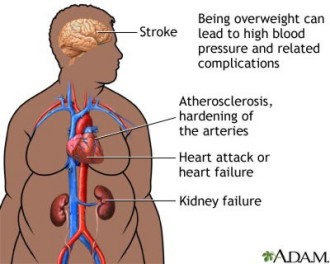 health-risks-of-obesity