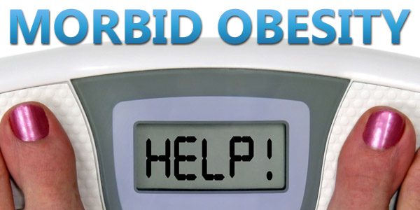 Morbid obesity help solution