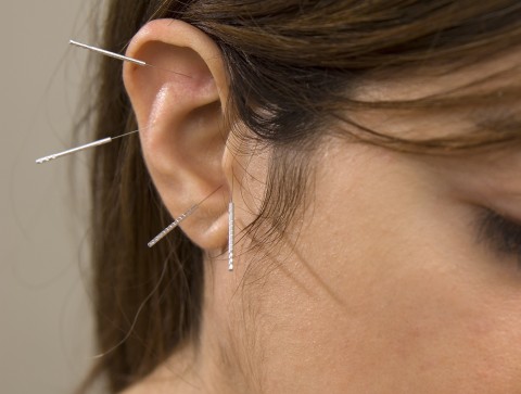 How does ear acupuncture works for weight loss