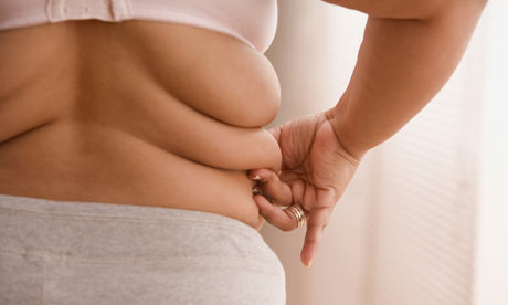 Overweight person considering bariatric surgery