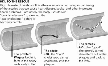 Good And Bad Cholesterol Factors