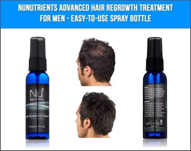 NuNutrients Advanced Hair Regrowth Treatment for Men - Easy-to-use Spray Bottle