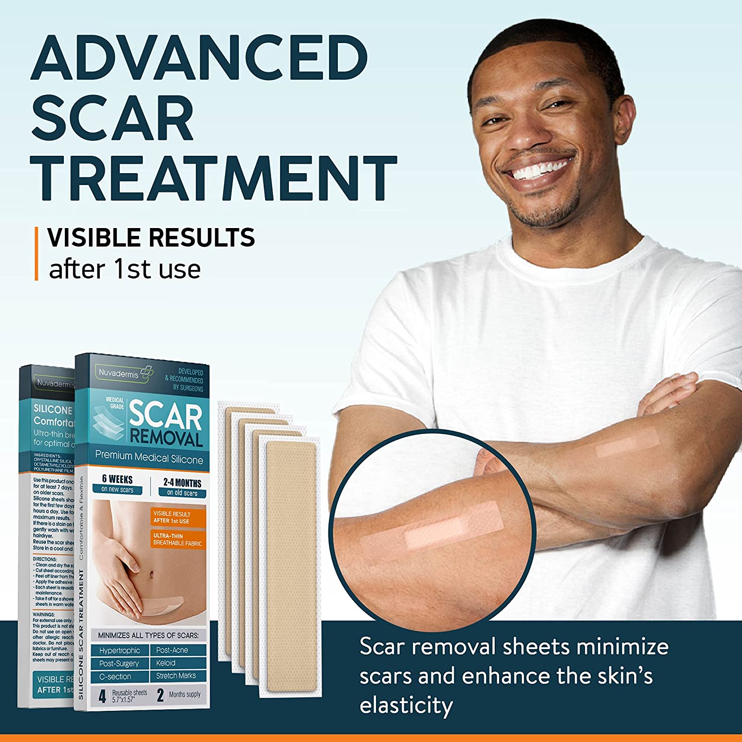 Advanced Scar Treatment Silicone Scar Removal Sheets by NUVADERMIS